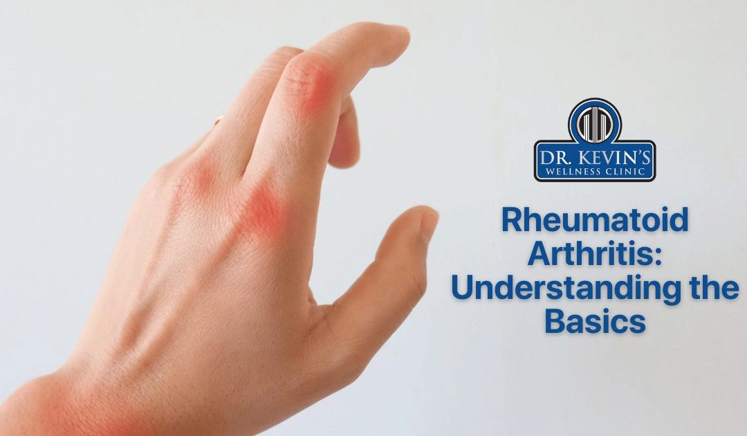 Rheumatoid Arthritis: Understanding the Basics